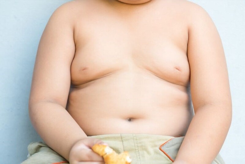 Trẻ béo phì, thừa cân